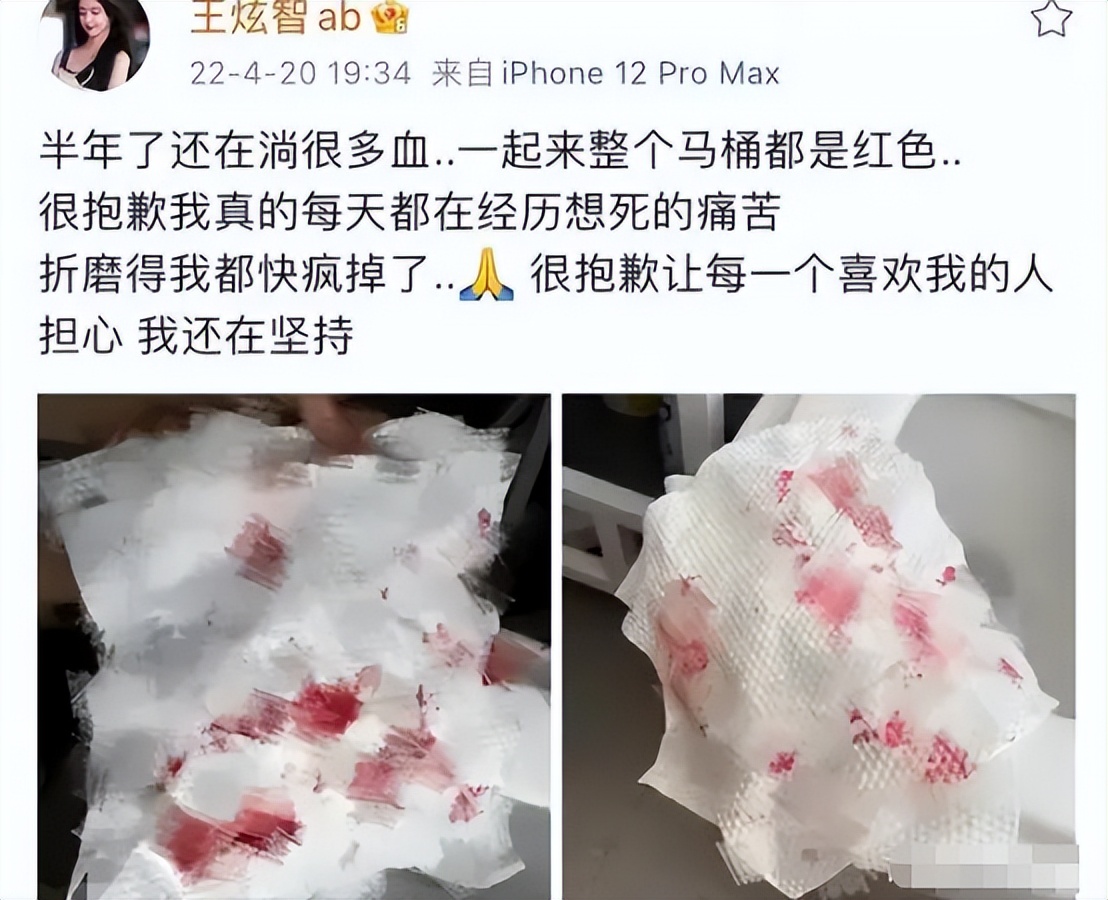 “年少拼刀子，只为女儿身”，19岁变性，女变男？网友：不太方便