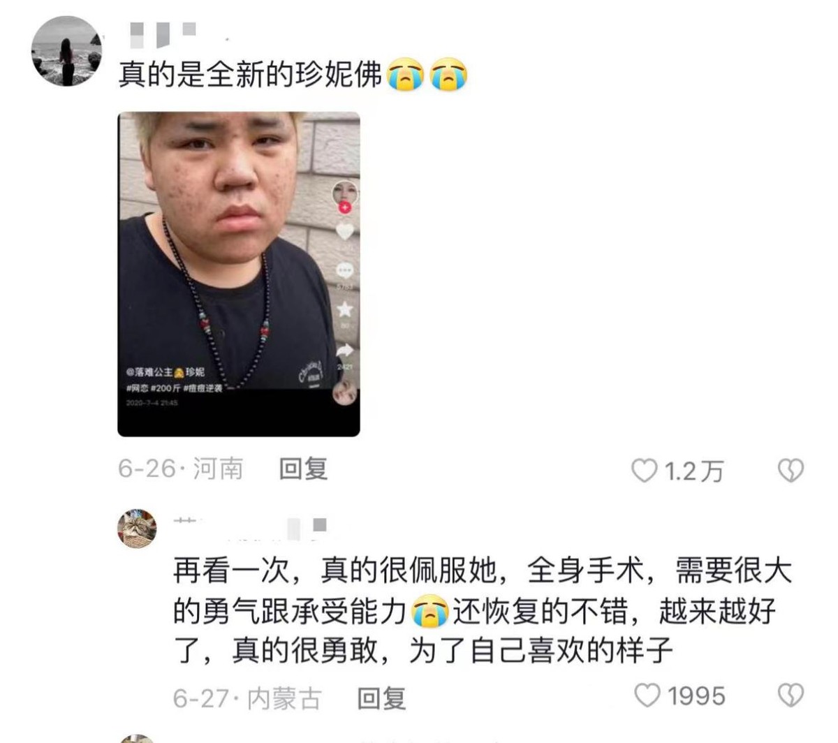 “年少拼刀子，只为女儿身”，19岁变性，女变男？网友：不太方便