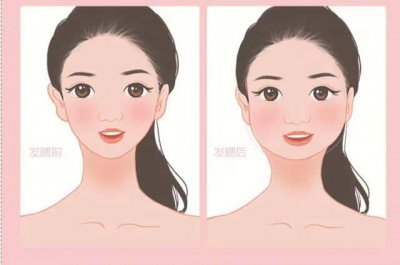 ​人发腮怎么办（发腮了还能变回去吗）