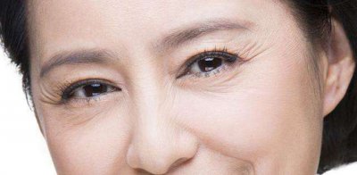 ​眼部皱纹怎么办去除小妙招（日常生活中这五个妙招让你轻松消除眼角纹）