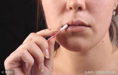 ​嘴唇经常干裂起皮，离不开这3个“元凶”，真希望你早点发现！