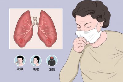 ​支气管炎干咳中药处方 支气管炎咳嗽用什么中药泡水喝