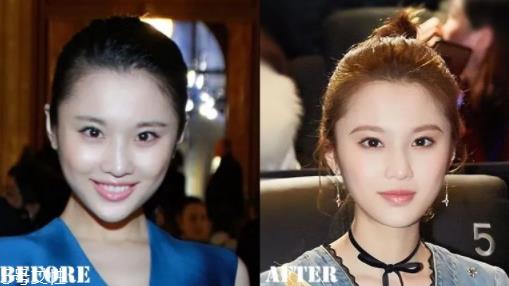 琅琊榜2张慧雯整容了吗？换了妆发美到不认识