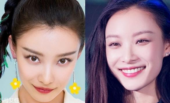 琅琊榜2张慧雯整容了吗？换了妆发美到不认识