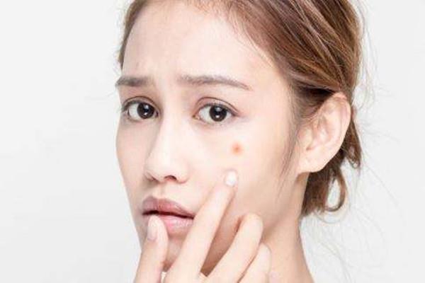 痘痘是怎么形成的 13岁女孩挤痘痘诱发败血症
