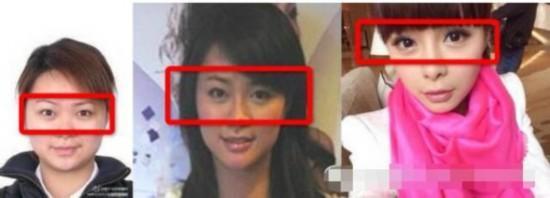 沈梦辰真的整容了？3张照片告诉你答案，最后一张“实锤”了！