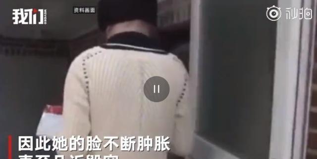 韩媒歌手：电风扇阿姨去世，曾疯狂迷恋整容面部肿胀无法入睡