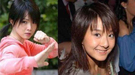 蝎子腿功俊俏女郎，甄子菁巴结美容圣手常好打架哥帮摆平