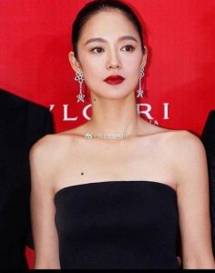 ​锁骨整形听过吗 30分钟就能get迷人锁骨窝