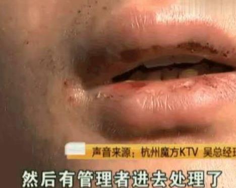 KTV男模陪4名女顾客喝酒, 上完厕所回来, 想不到被其他男模暴打