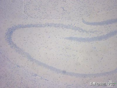 ​教你认识免疫组化切片图-海马体