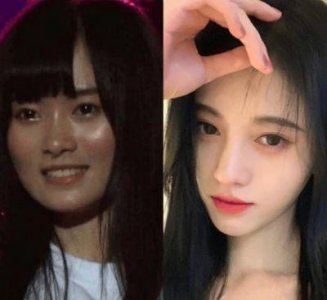 ​鞠婧祎整容前后对比照曝光，容貌气质大不如前，引发网友热议
