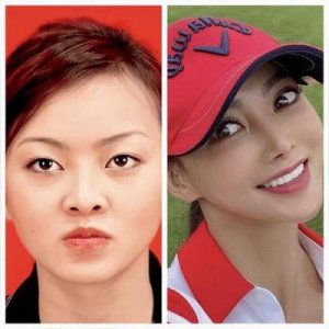 ​香港著名男星的前妻沉迷于整形，下巴变得尖细如锥，越来越像真人芭比娃娃