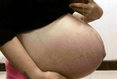 ​第一次见这种孕肚，直接从肚子里凸出来，网友：不会是双胞胎吧