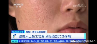 ​今年火遍全网的刷酸，到底是美容还是毁容？
