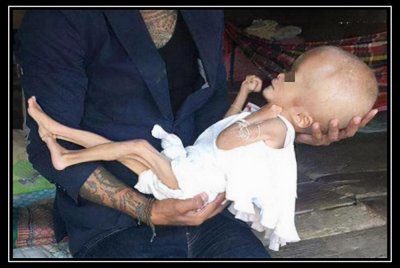 ​三聚氰胺事件13年后，当事人即将出狱，受害的30万婴儿都怎样了？