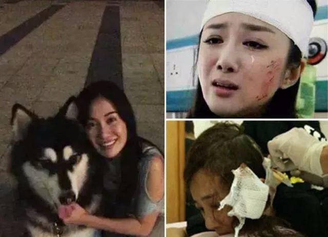 李依晓被叶璇的狗咬（李依晓被狗咬伤提告讨公道）(14)