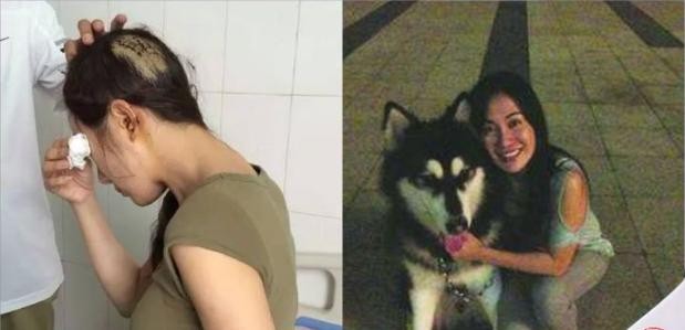 李依晓被叶璇的狗咬（李依晓被狗咬伤提告讨公道）(11)