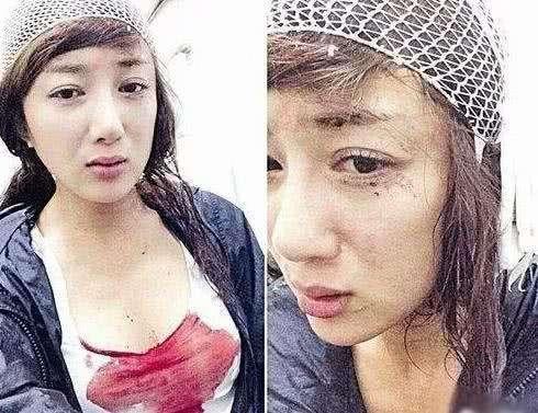 李依晓被叶璇的狗咬（李依晓被狗咬伤提告讨公道）(10)