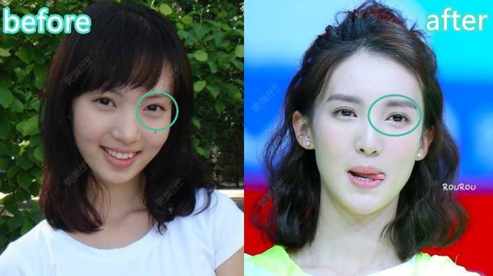 金晨怎么变丑了鼻子怎么了脸怎么那么歪?金晨肯定整容失败细节图