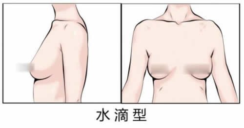 水滴型的胸部是什么样的 算得上是完美的胸型