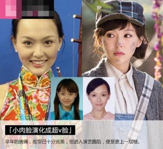 ​唐嫣整容前后照片对比 唐嫣脸部的变化