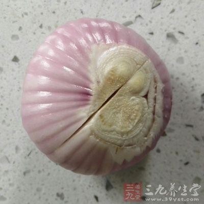 什么原因会导致头皮屑变多（七大原因导致头皮屑增多）(3)