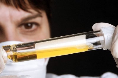 ​公务员尿检很严格，具体检查哪些？