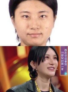 ​尚雯婕面部整形前后对比：为何总是遮挡脸部？